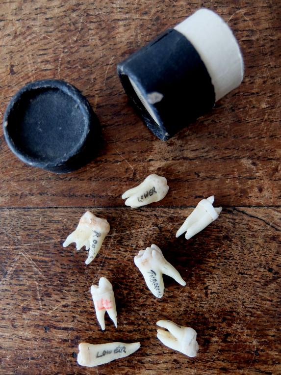 Teeth Specimens (EA0417X)