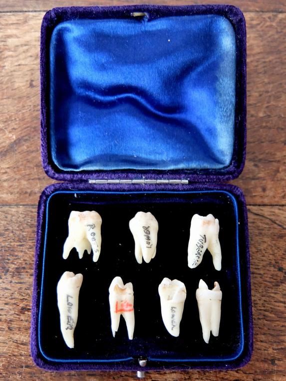 Teeth Specimens (Z0417)