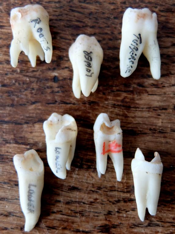 Teeth Specimens (A0417)